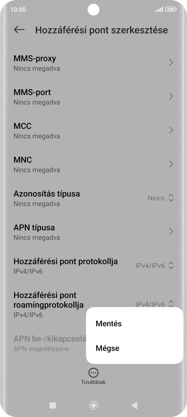 Válaszd a Mentés lehetőséget. Válaszd a Mentés lehetőséget.