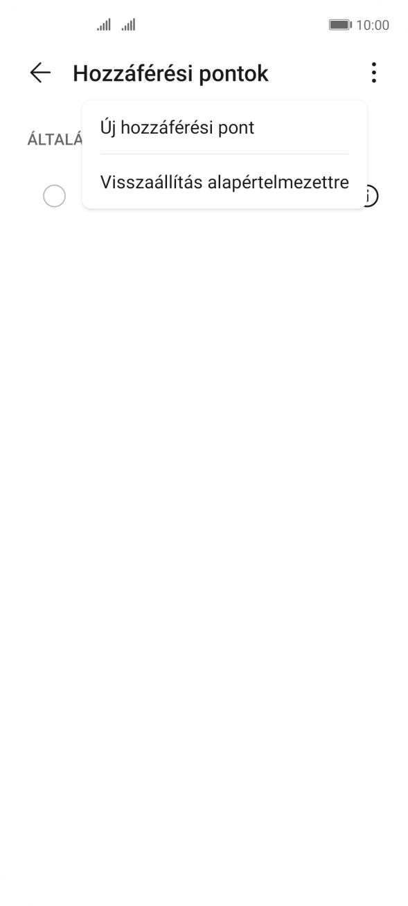 Válaszd az Új hozzáférési pont lehetőséget. Válaszd az Új hozzáférési pont lehetőséget.