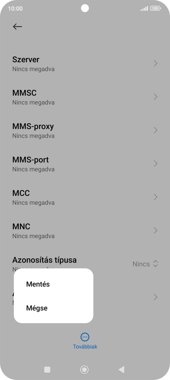 Válaszd a Mentés lehetőséget. Válaszd a Mentés lehetőséget.