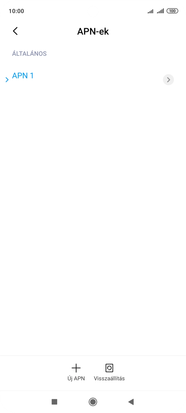 Válaszd az Új APN lehetőséget. Válaszd az Új APN lehetőséget.