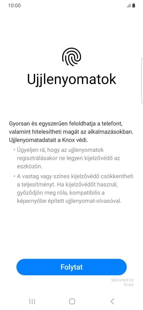 Válaszd a Folytat lehetőséget. Válaszd a Folytat lehetőséget.