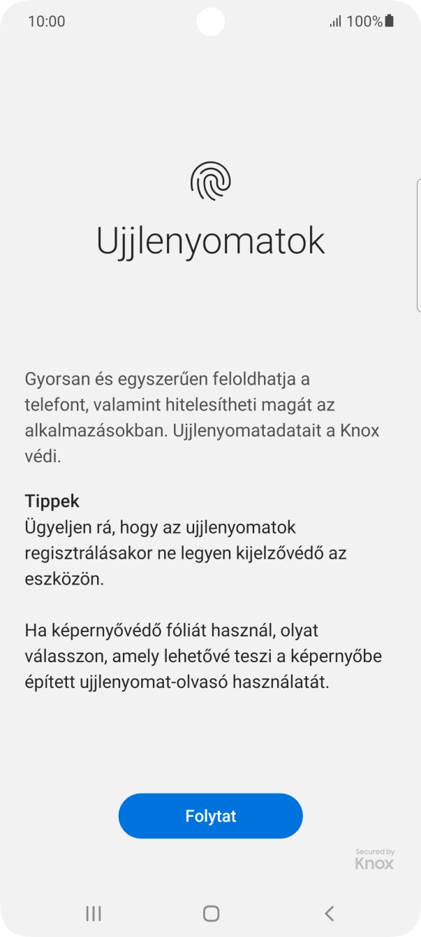 Válaszd a Folytat lehetőséget.