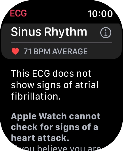 The result is displayed.