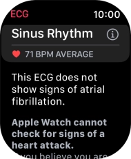 The result is displayed. The result is displayed.