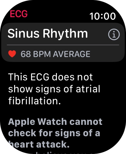 The result is displayed.