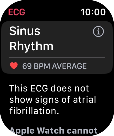 The result is displayed.