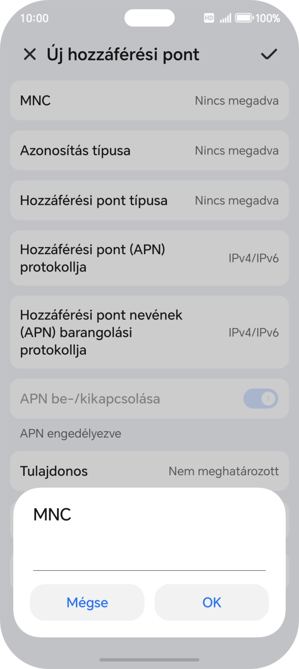 Írd be azt, hogy 70, és válaszd az OK lehetőséget. Írd be azt, hogy 70, és válaszd az OK lehetőséget.