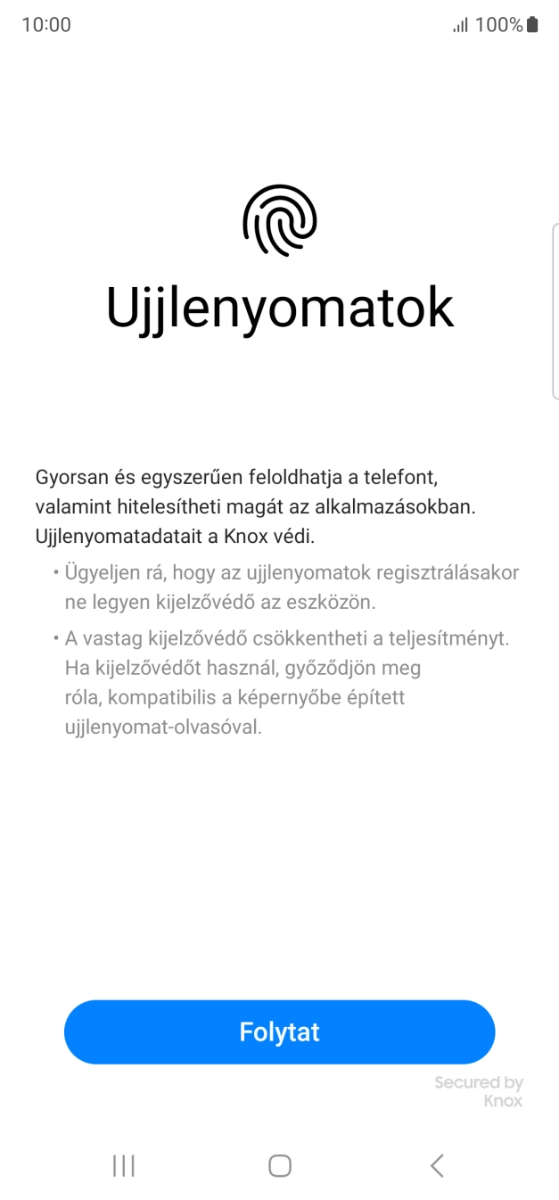 Válaszd a Folytat lehetőséget.