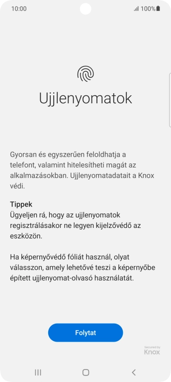 Válaszd a Folytat lehetőséget.