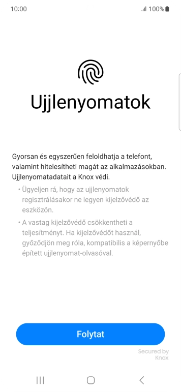 Válaszd a Folytat lehetőséget.