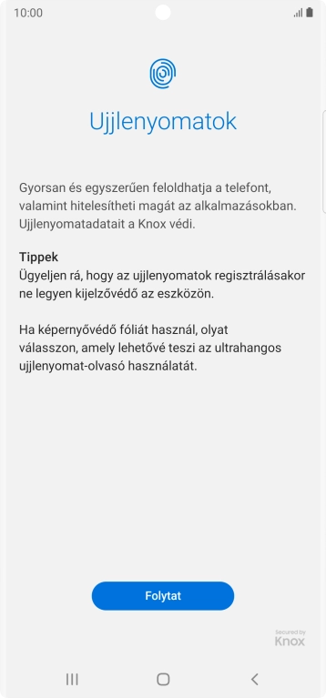 Válaszd a Folytat lehetőséget.