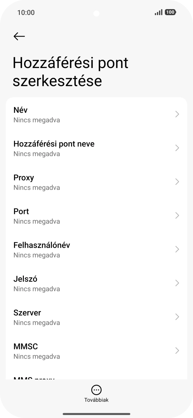 Válaszd a Név lehetőséget. Válaszd a Név lehetőséget.
