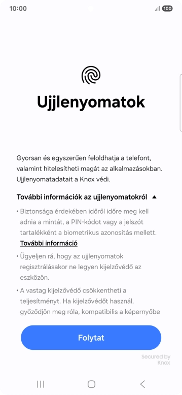 Válaszd a Folytat lehetőséget.