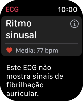 O resultado é agora mostrado no ecrã.