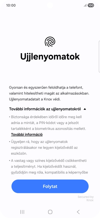 Válaszd a Folytat lehetőséget.