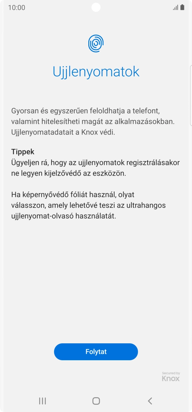 Válaszd a Folytat lehetőséget.