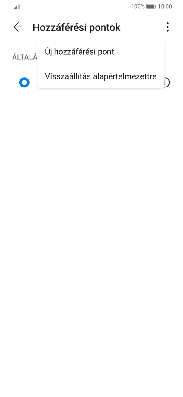 Válaszd az Új hozzáférési pont lehetőséget.