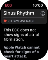 The result is displayed.