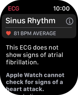 The result is displayed.