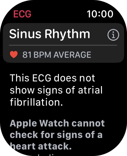 The result is displayed. The result is displayed.