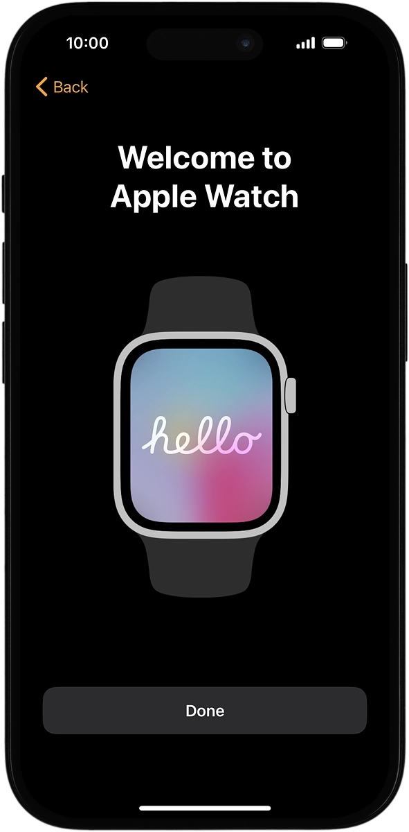 On your phone: Wait a moment while the activation of your Apple Watch is completed and press Done.