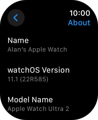 The software version of your Apple Watch is displayed below watchOS Version. The software version of your Apple Watch is displayed below watchOS Version.
