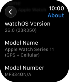 The software version of your Apple Watch is displayed below watchOS Version. The software version of your Apple Watch is displayed below watchOS Version.