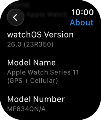 The software version of your Apple Watch is displayed below watchOS Version. The software version of your Apple Watch is displayed below watchOS Version.