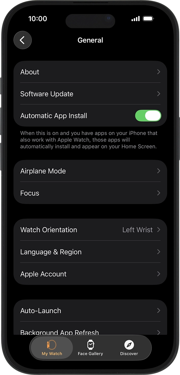On your phone: Press Software Update. If a new software version is available, it's displayed. Follow the instructions on the screen to update the Apple Watch software.