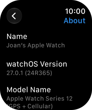 The software version of your Apple Watch is displayed below watchOS Version. The software version of your Apple Watch is displayed below watchOS Version.