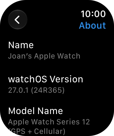 The software version of your Apple Watch is displayed below watchOS Version. The software version of your Apple Watch is displayed below watchOS Version.