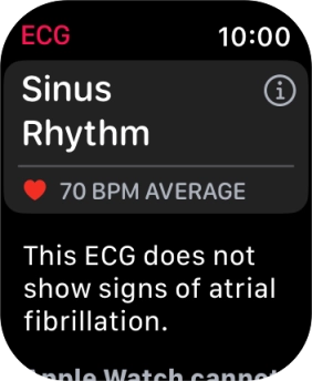 The result is displayed.