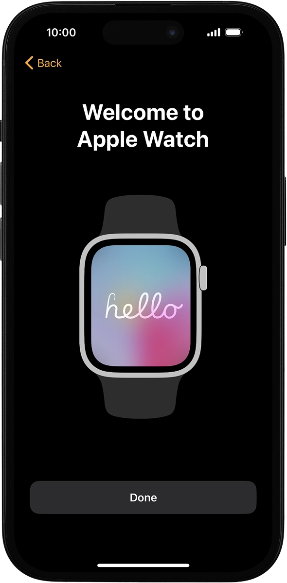 On your phone: Wait a moment while the activation of your Apple Watch is completed and press Done.