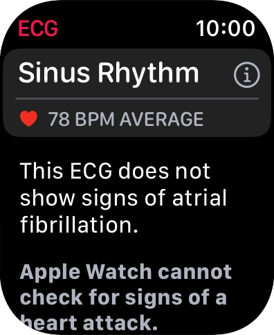 The result is displayed.