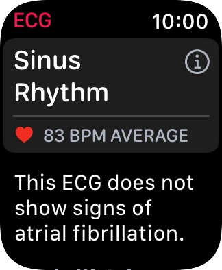 The result is displayed.