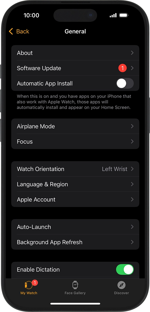 On your phone: Press Software Update. If a new software version is available, it's displayed. Follow the instructions on the screen to update the Apple Watch software.