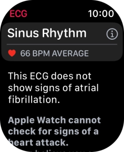 The result is displayed.