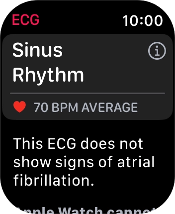 The result is displayed.