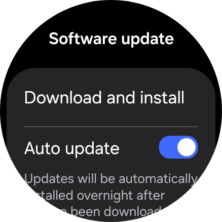 Press Download and install. If a new software version is available, it's displayed. Follow the instructions on the screen to update the smartwatch software.