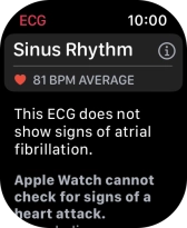 The result is displayed.