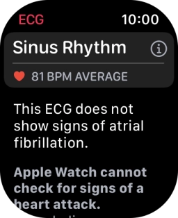 The result is displayed.