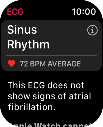 The result is displayed. The result is displayed.