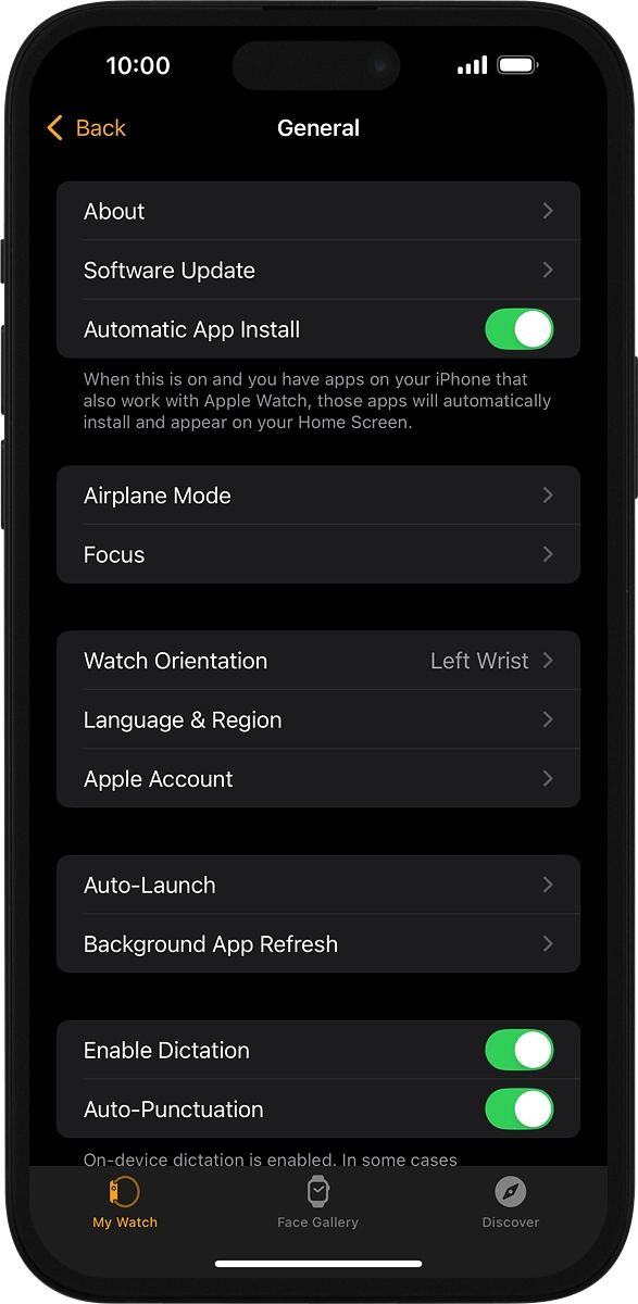 On your phone: Press Software Update. If a new software version is available, it's displayed. Follow the instructions on the screen to update the Apple Watch software.