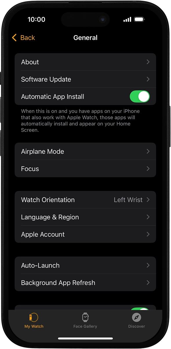 On your phone: Press Software Update. If a new software version is available, it's displayed. Follow the instructions on the screen to update the Apple Watch software.